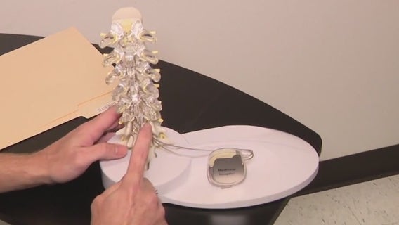 50-year-old pain relief treatment gets an improvement