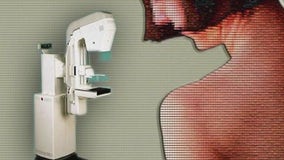 Breast cancer screenings to include new analysis