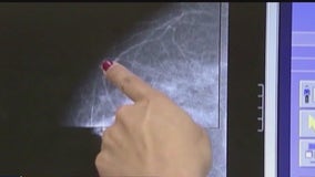 Breast cancer diagnoses among younger women