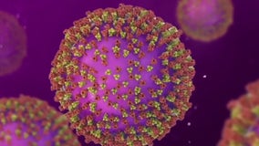 Measles spreads in Texas