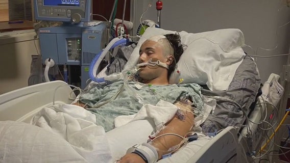 Houston baseball player survives life-threatening brain aneurysm