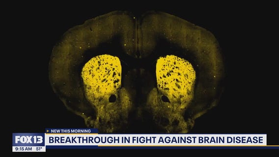 Breakthrough in fight against brain disease