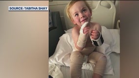 Florida mom’s message one year after fire accident: ‘Pants melting to the back of his legs’