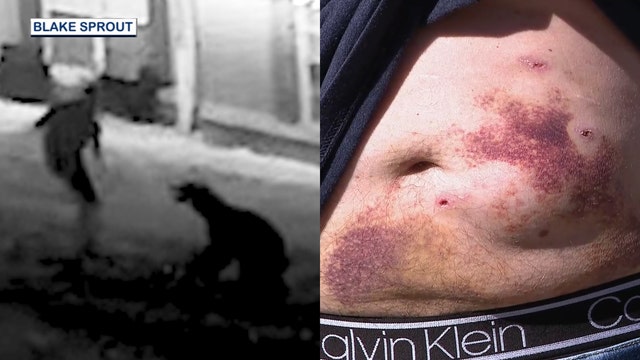 VIDEO: Florida man attacked by bear while trying to save his dog