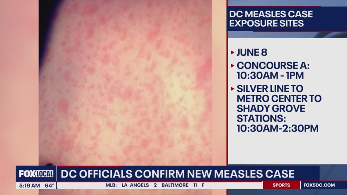 DC measles case confirmed