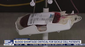 Blood shortage critical for sickle cell patients