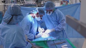 First awake kidney transplant performed