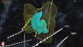 Virtual reality helps Corewell doctors understand patients' brains