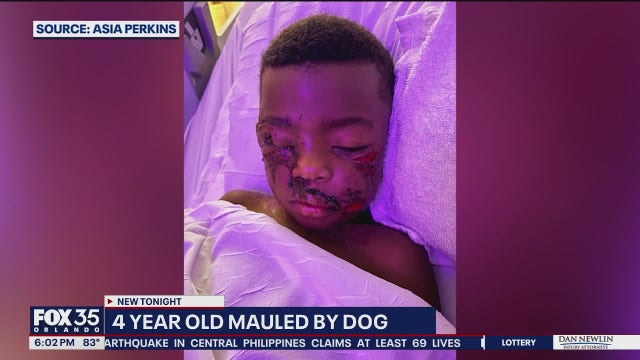 Vicious dog attack leaves 4-year-old Daytona Beach boy badly injured