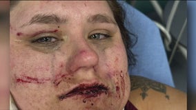 Oakland woman brutally attacked by group of young people