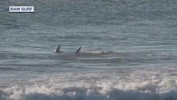 Shark bites surfer 'Gnarly Charley' in New Smyrna Beach: 'I could just feel it go clamp'