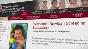 Wisconsin 'falling behind' in newborn screening