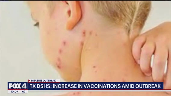 Texas measles outbreak 2025: Dozens of new cases confirmed in West Texas