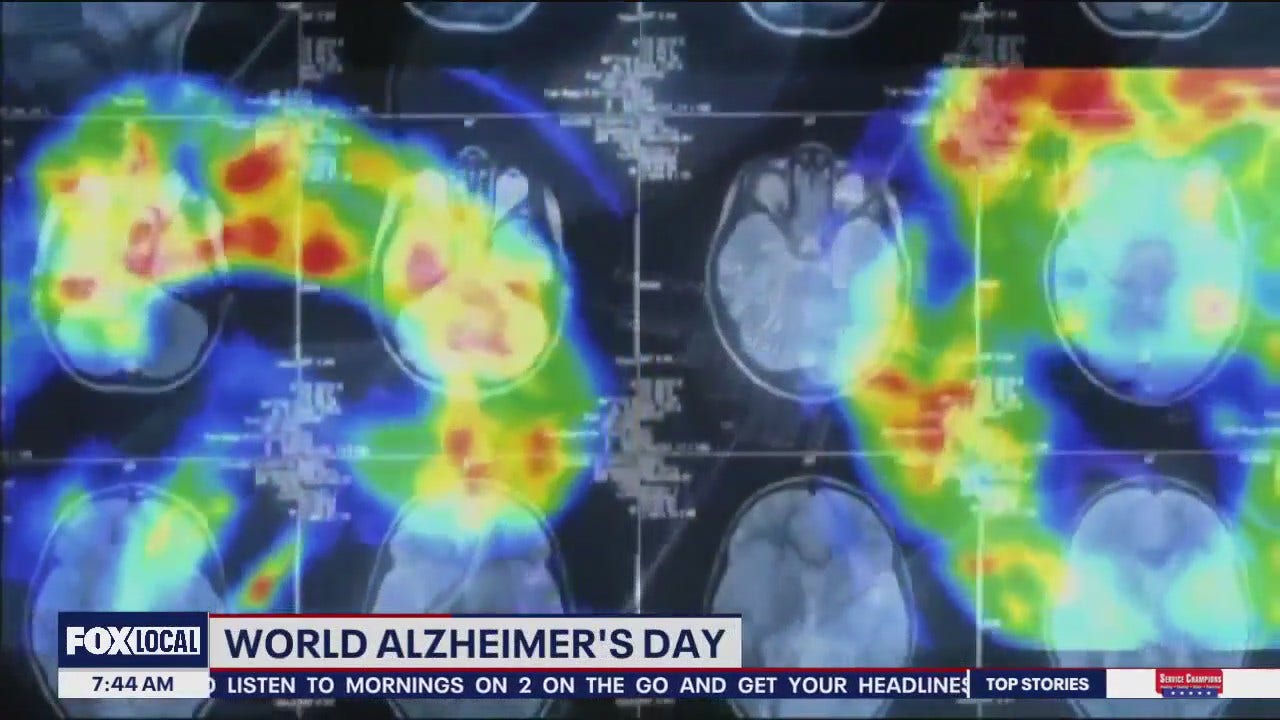 Author of "Future of Alzheimers" book shares research on managing diagnosis and treatment
