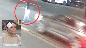 Los Angeles woman gets run over by 2 hit-and-run drivers