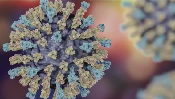 More measles cases confirmed in U.S. states