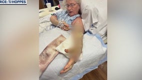 Woman bitten by rattlesnake in yard