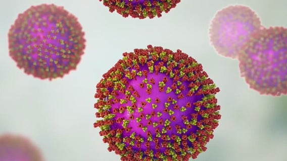 Texas measles outbreak: Spread appears to slow in West Texas