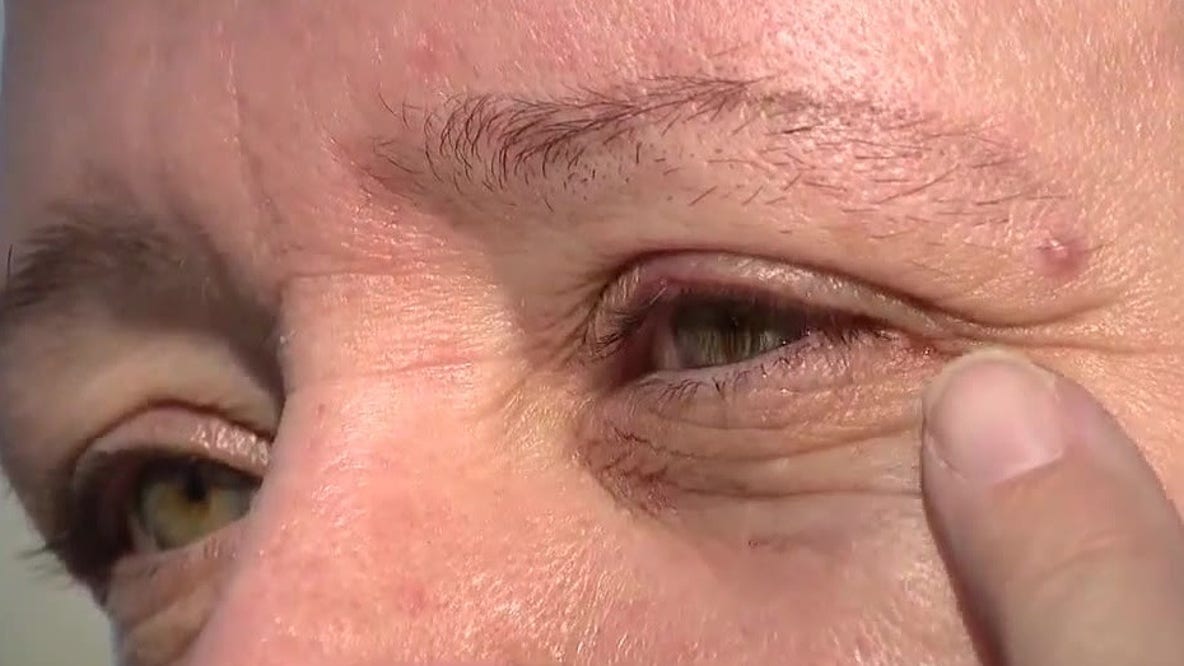 Woman injured after being hit by water balloon