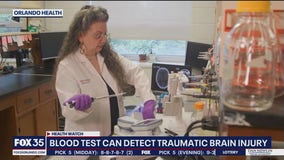 Blood test can detect traumatic brain injury