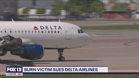 Burn victim sues Delta airlines over coffee spill