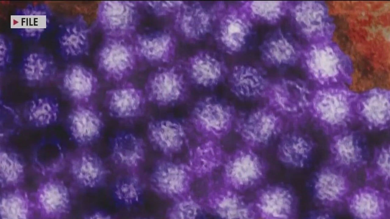 How to protect yourself from Norovirus as cases go up | FOX 2 Detroit