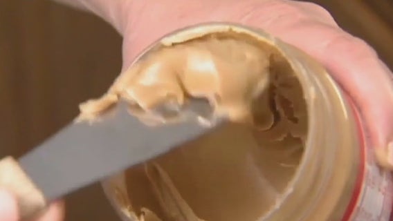 Food allergies: Number of cases in children drops