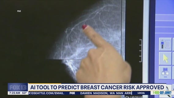 AI tool to predict breast cancer risk approved by FDA