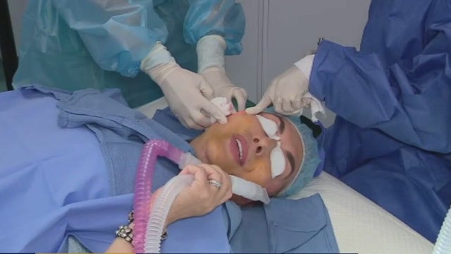 'Endolift' facelift uses new cutting-edge laser, alternative to traditional facelifts