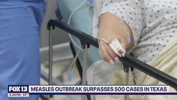 Measles outbreak surpasses 500 cases in Texas