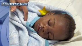 'Sharing Smiles' helps kids with cleft palates