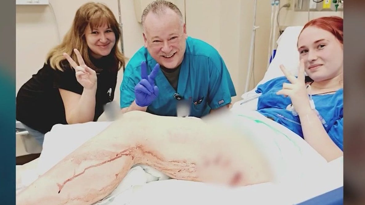 15-year-old speaks out after fighting off 10-foot gator