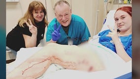 Teen girl attacked, bitten by 10-foot alligator in Florida, deputies say