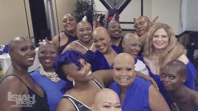 Houston locals talk alopecia awareness