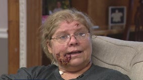 Willis woman and her family brutally attacked by her neighbor's 8 pit bulls