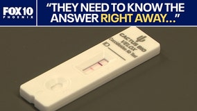 Valley Fever: ASU, Mayo team up for fast test