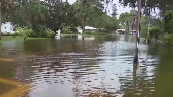 Florida reports four deaths from flesh-eating bacteria so far in 2025