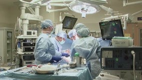 New milestone for liver transplants at Mayo Clinic