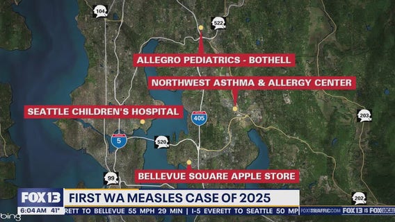 First WA measles case of 2025