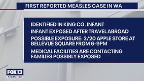First WA measles case of 2025 confirmed