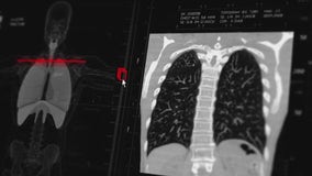 American Lung Association offering lung screenings to Illinois residents