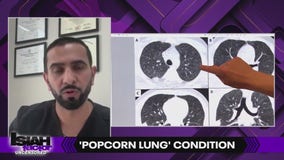 Risks of vaping: popcorn lung