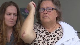 Meijer parking lot attack in Lincoln Park leaves woman bruised