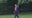 Trump diagnosed with chronic venous insufficiency