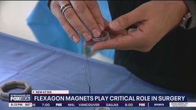 Florida hospital uses magnets, not stitches, in some surgeries