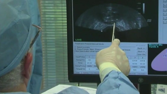 Colorectal cancer diagnoses increasing with expanded screenings