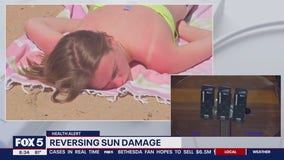 Reversing sun damage