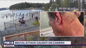 Tacoma man, 73, speaks out after brutal assault by group of seven