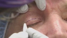 Cutting-edge cosmetic procedure to restore eyes