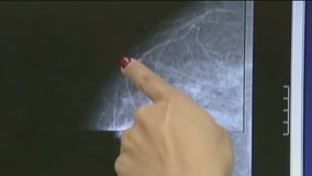 Breast cancer rates rise in younger women